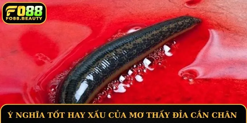 Nhiều điềm báo liên quan đến việc mơ thấy đỉa cắn chân